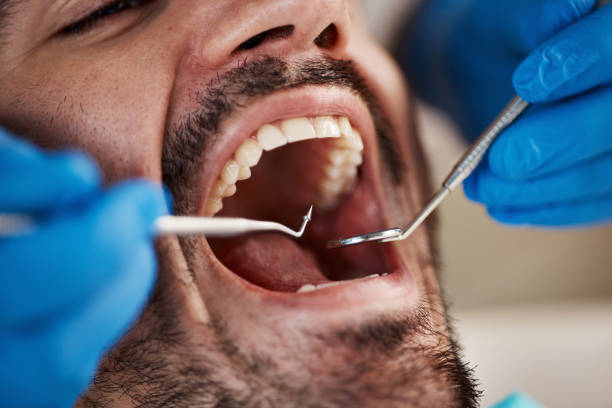 Best Emergency Dentist for Lost Fillings or Crowns in Marfa, TX