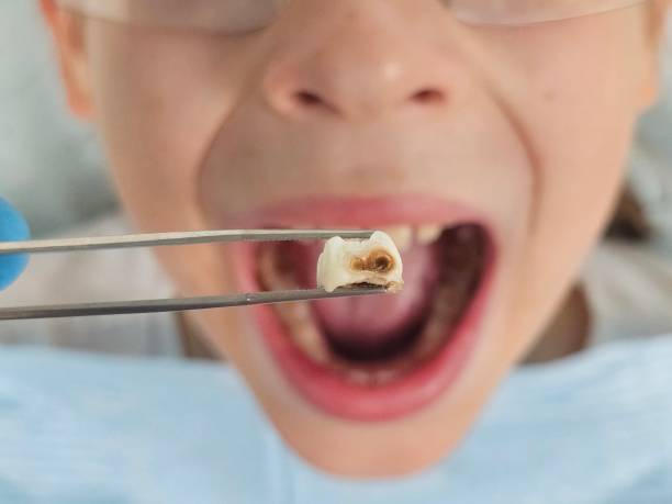 Best Orthodontic Emergency Dentist in Marfa, TX